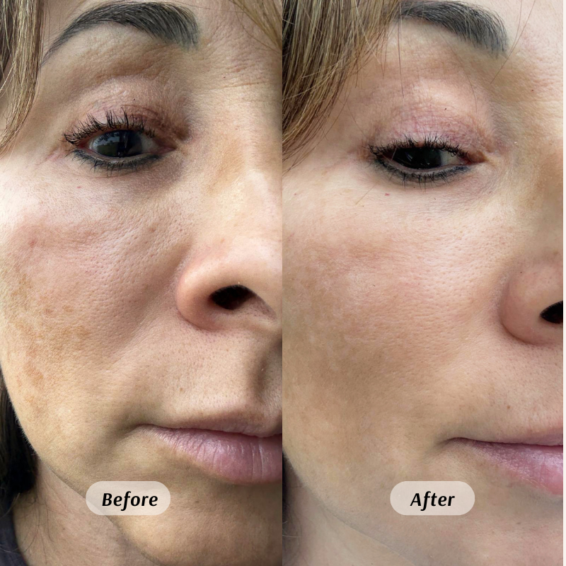 Organic Castor Oil Roll-on With Frankincense