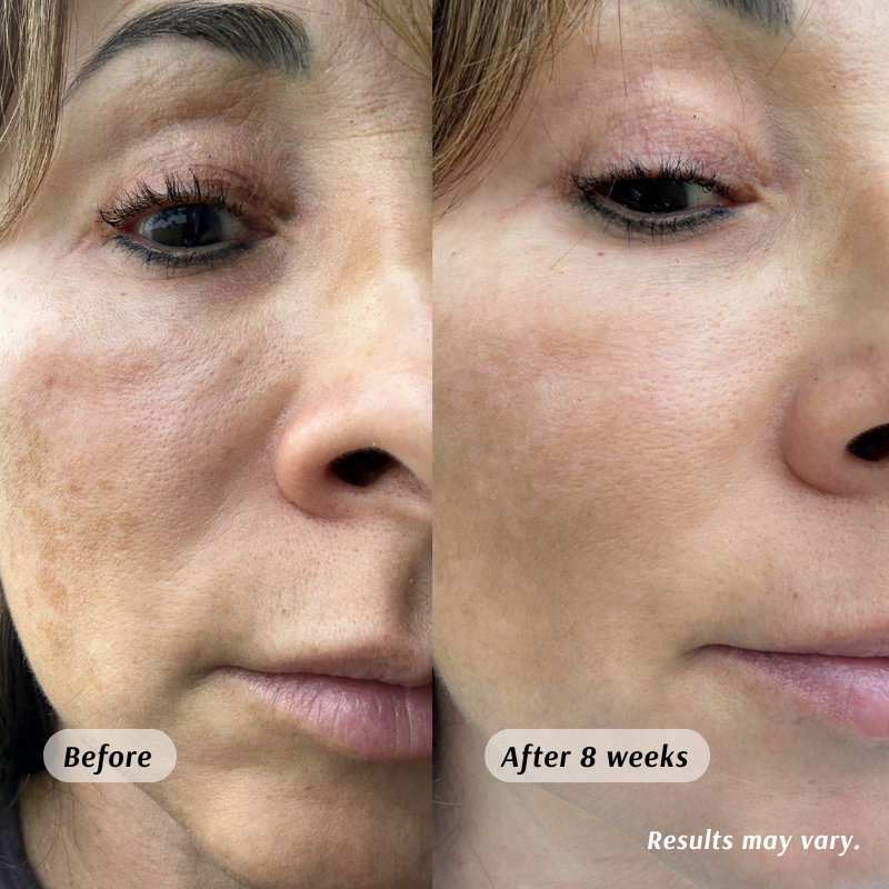 Before and after 8 weeks of using Frankincense & Castor Oil for smoother-looking skin