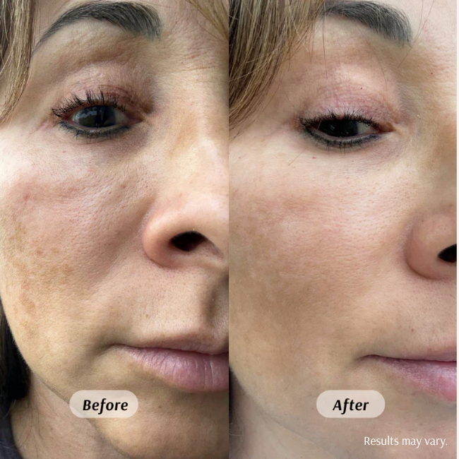 Before and after using the Frankincense & Castor Oil roll-on