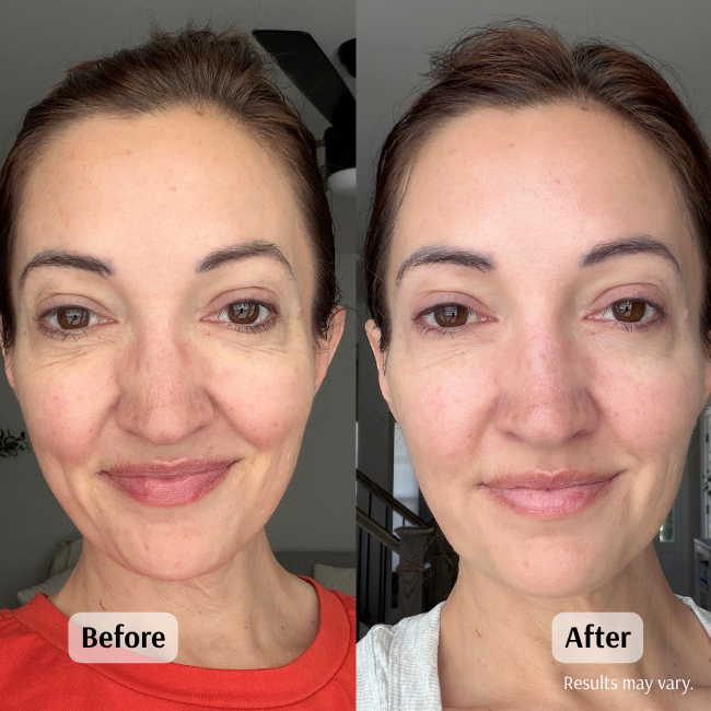 Before and after using the Frankincense & Castor Oil roll-on