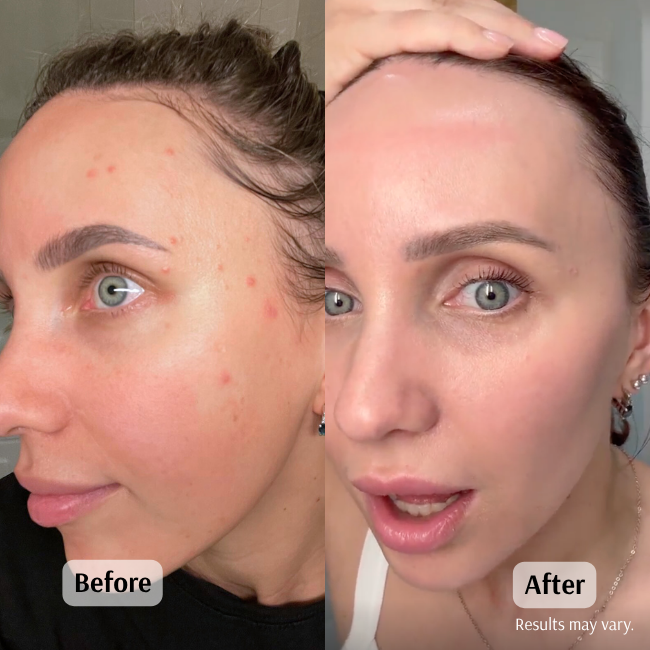 Before and after using the Frankincense & Castor Oil roll-on