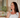 Castor Oil for Sunburn: Why It Comes After Aloe