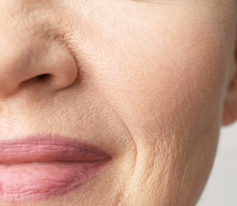 Why Women 40+ Are Replacing Wrinkle Creams with Frankincense & Castor Oil