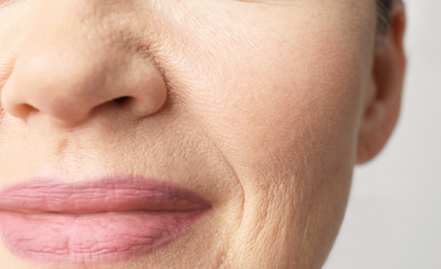 Why Women 40+ Are Replacing Wrinkle Creams with Frankincense & Castor Oil