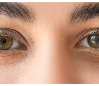 Castor Oil for Dark Circles: The Hormone-Safe Ritual That Clears Puffiness Naturally