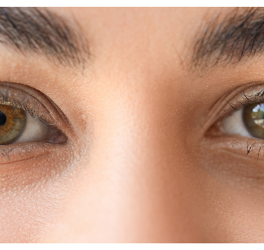 Castor Oil for Dark Circles: The Hormone-Safe Ritual That Clears Puffiness Naturally