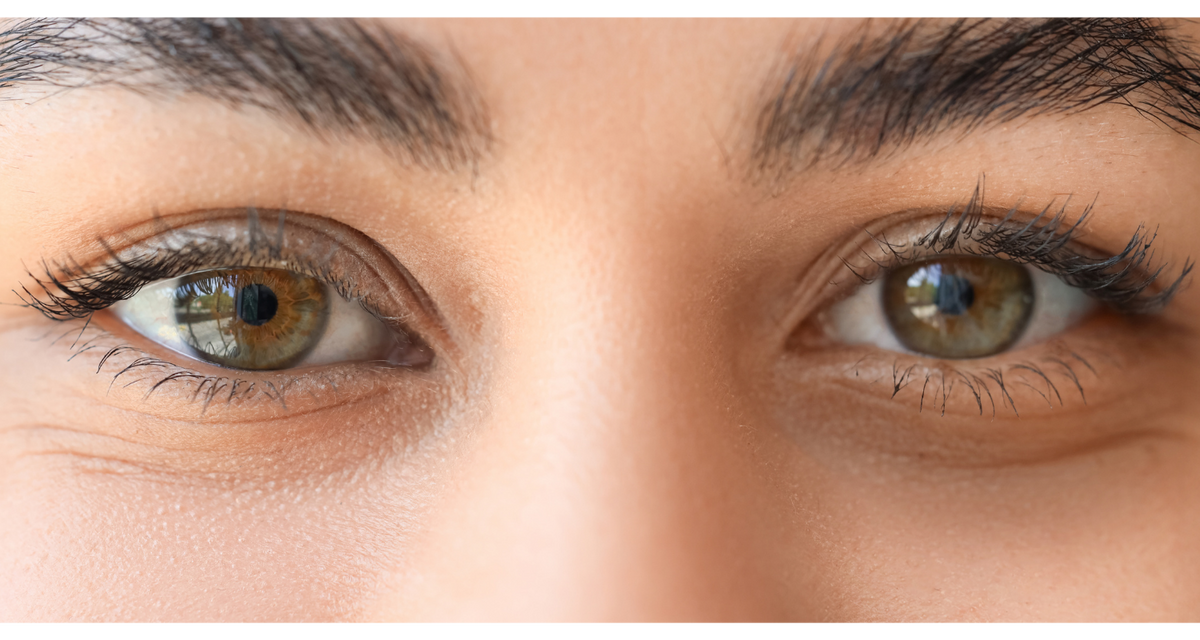 Castor Oil for Dark Circles: The Hormone-Safe Ritual That Clears Puffiness Naturally