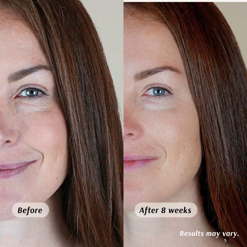 Frankincense Gua Sha Contour Kit by Holistic Goddess – before and after 8 weeks skin comparison photo