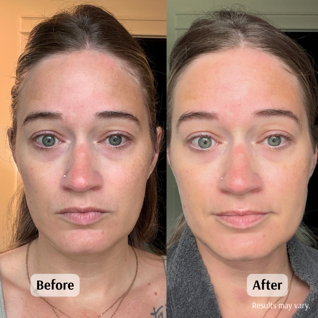 Before and after using the Frankincense & Castor Oil roll-on